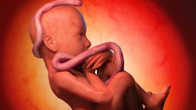 Spiritual Meanings of Umbilical Cord around the Neck